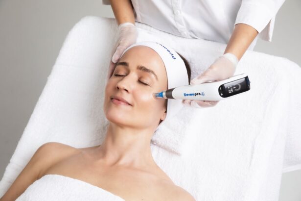 dermapen 4